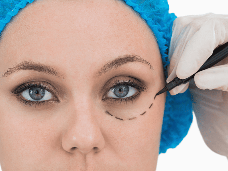 goz-kapagi-ameliyati-ve-goz-cevresi-estetigi
